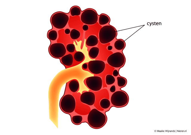 cystenier