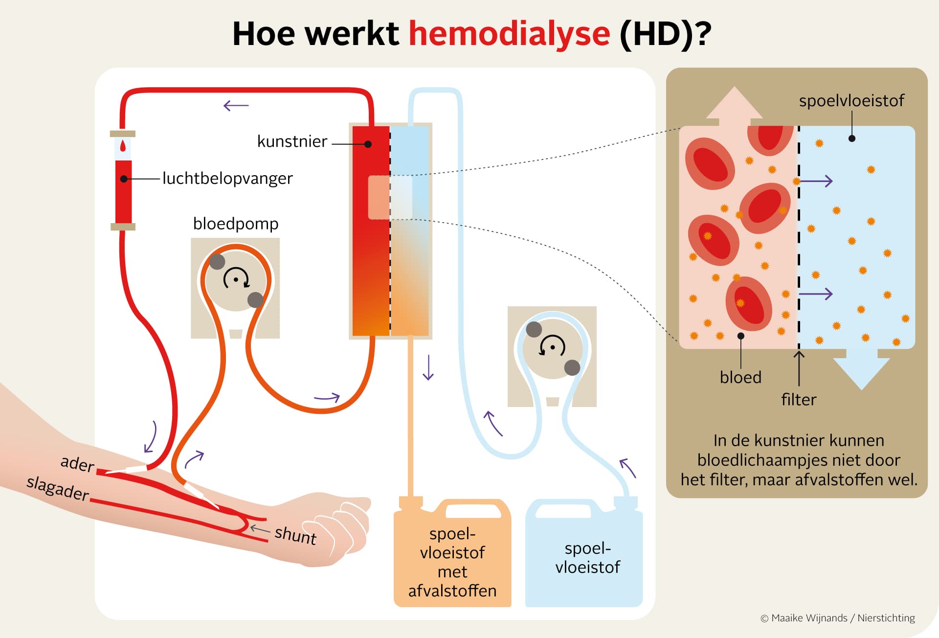 Schematische weergave van hemodialyse.
