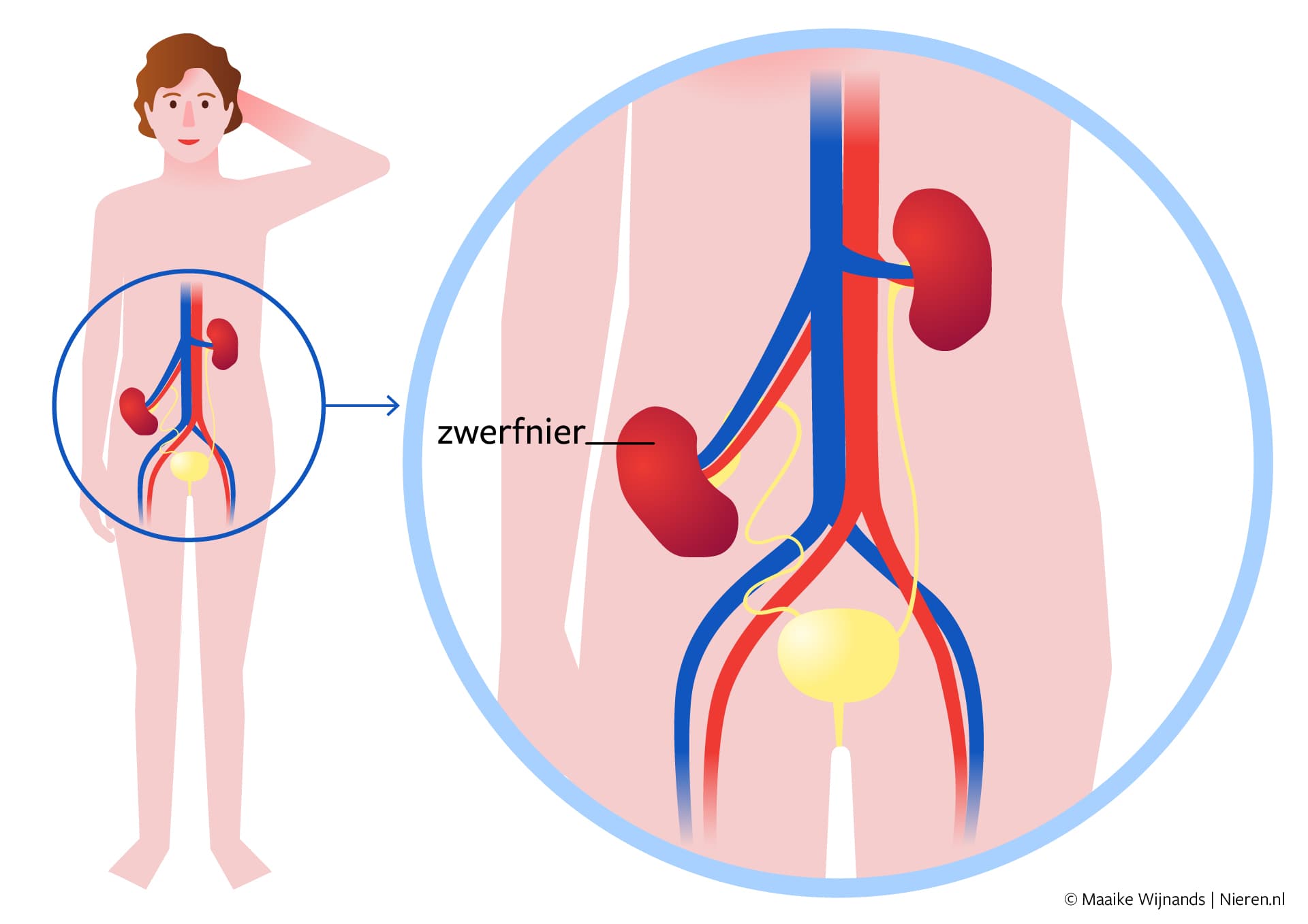 zwerfnier