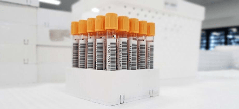Onbegrepen nierziekte onder de loep: ligt het antwoord in ons DNA?