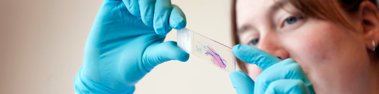 RegMed XB een nier uit het lab